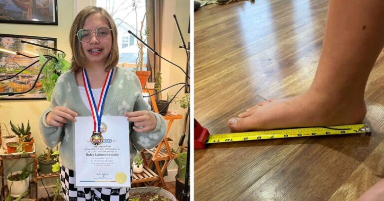 10-year-old-big-feet-ruby-labuschewsky