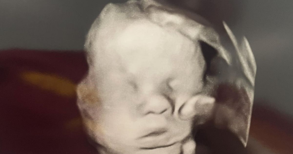 hand of god ultrasound amanda foster